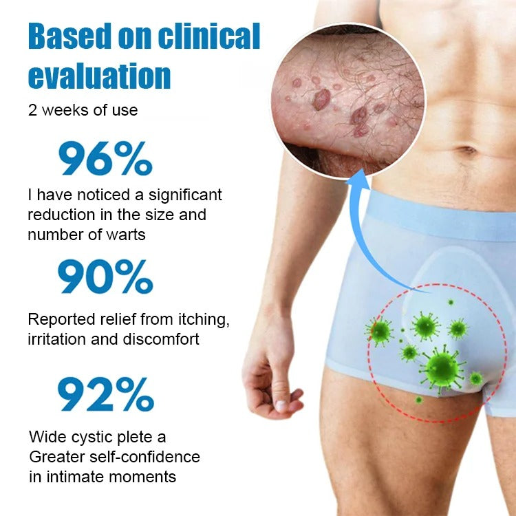 NNLP Smooth Skin Wart Removal Cream