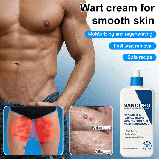 NNLP Smooth Skin Wart Removal Cream