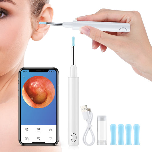 Smartbud Visual Ear CLeaner