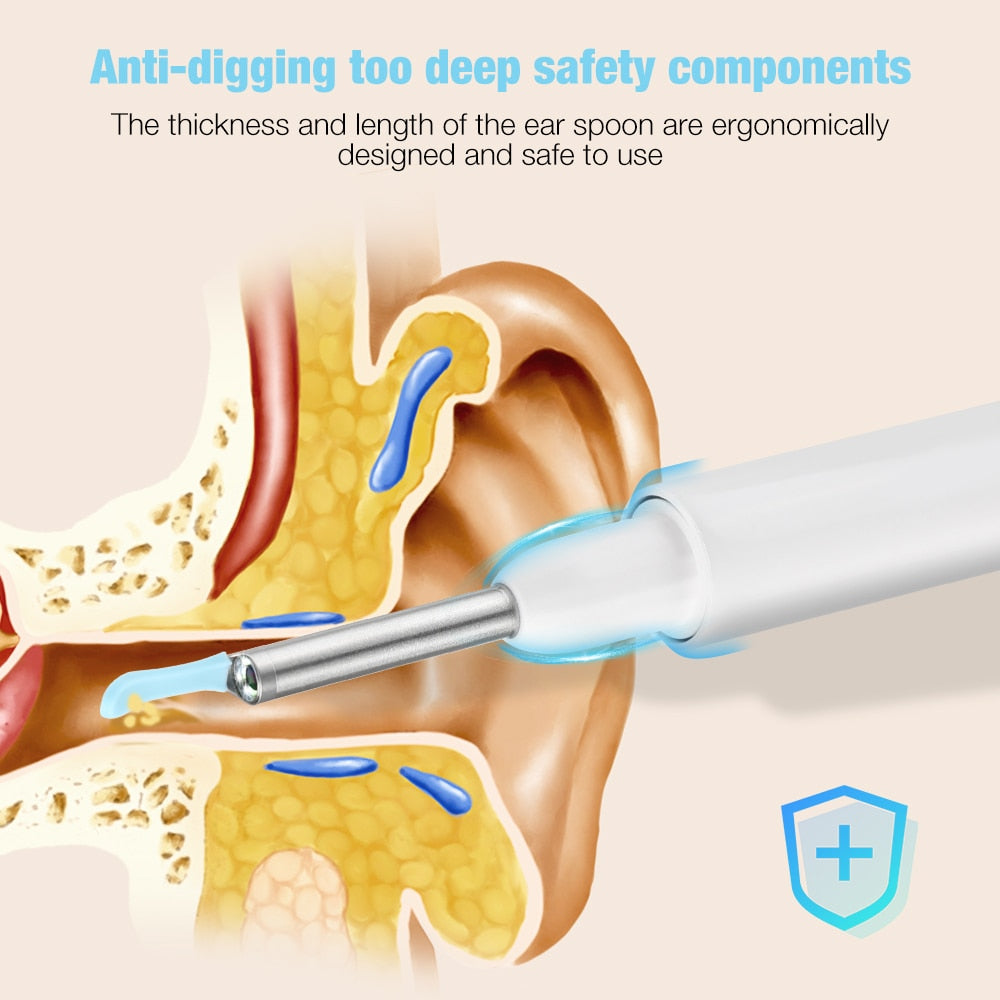 Smartbud Visual Ear CLeaner